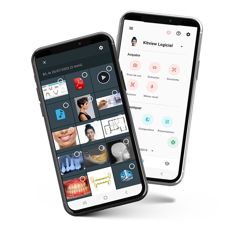 kitview smartphone